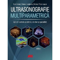 Ultrasonografie multiparametric&259; Aplica&539;ii centrate pe tehnici aborduri &537;i specialit&259;&539;iUltrasonografia modern&259; &icirc;ntre performan&539;&259; tehnologic&259; interpretare clinic&259; &537;i diagnostic multiparametric&nbsp;Crea&539;ie a unui colectiv de autori coordonat de Prof Dr Radu Badea una dintre personalit&259;&539;ile de referin&539;&259; ale &537;colii rom&acirc;ne&537;ti de 
