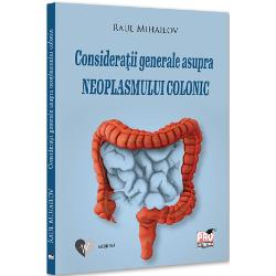 Considera&539;ii generale asupra neoplasmului colonic&nbsp;reprezint&259; o sintez&259; a datelor cunoscute despre o patologie extrem de frecvent&259; &icirc;n practica curent&259; &icirc;ndeosebi &icirc;n urgen&539;&259; &icirc;n fazele complica&539;iilor v&259;zut&259; prin ochii unui practician&nbsp;Lucrarea se adreseaz&259; studen&539;ilor de la facult&259;&539;ile de medicin&259; care vor s&259; &icirc;n&539;eleag&259; &537;i 