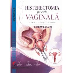 Histerectomia pe cale vaginala