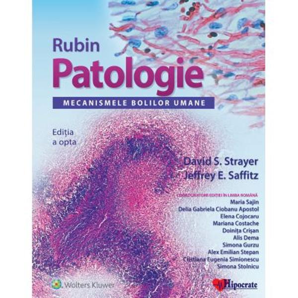 Rubin Patologie edi&539;ia a 8-a este u&537;or de citit &537;i bogat&259; în ilustra&539;ii vibrante determinând într-un mod abordabil acumularea de cuno&537;tin&539;e-cheie de patologie &537;i sedimentarea unei baze medicale util&259; pentru succesul clinic Aceasta permite accesarea informa&539;iilor de care ave&539;i nevoie cel mai mult – mecanismele fiziopatologice ale bolilor integrarea acestora în cadrul patologiilor sistemelor de organe 