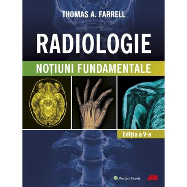 ACR &537;i Societatea de Radiologie a Americii de Nord au format un grup operativ pentru a aborda tema radioprotec&539;iei la adul&539;i bazându-se pe succesul campaniei Imagistic&259; Blând&259; pentru copii Scopul acestui grup operativ a fost s&259; educe furnizorii cu privire la necesitatea &537;i oportunitatea elimin&259;rii examin&259;rilor imagistice inutile &537;i sc&259;derea cantit&259;&539;ii radia&539;iilor folosite în imagistic&259; la cea 