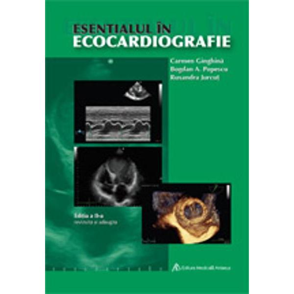Esentialul in ecocardiografie ed a II a
